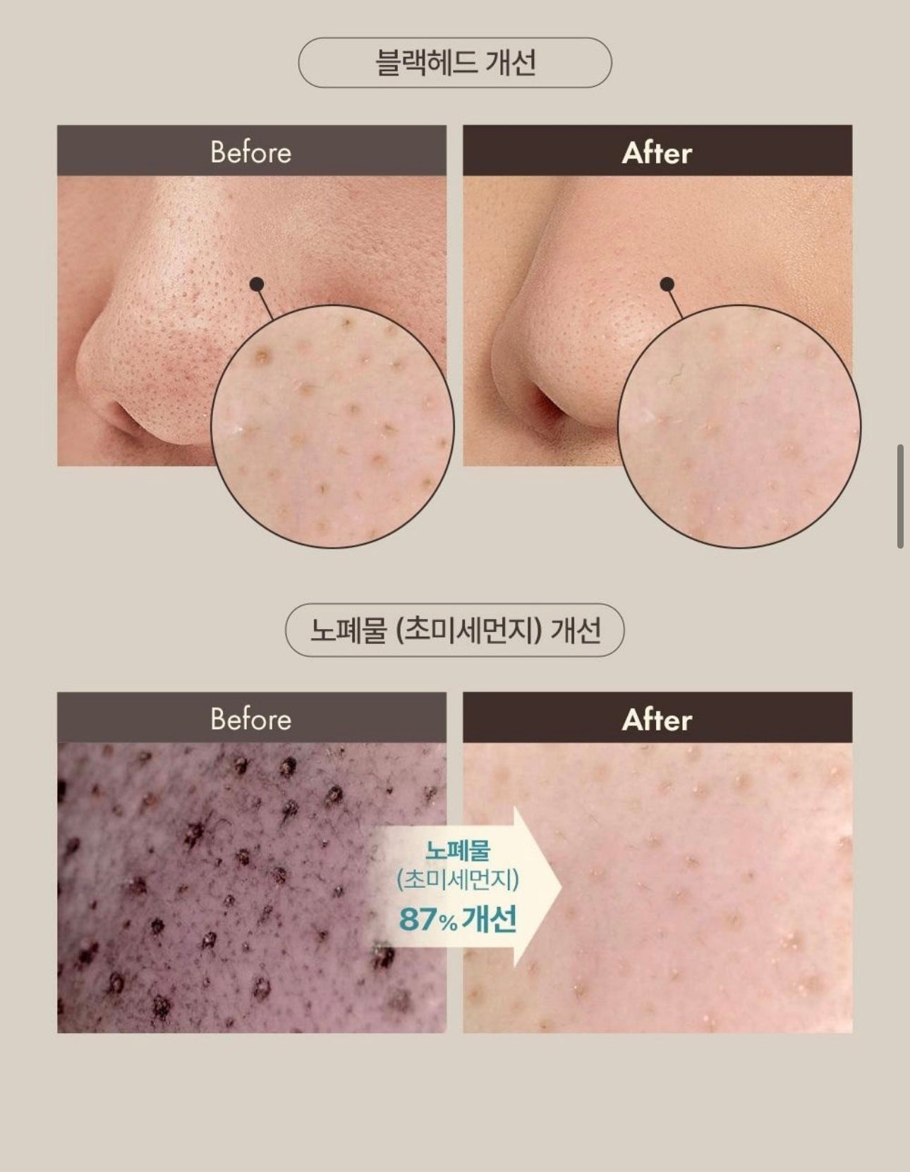 OBgE 黑頭粉刺去角質清潔棒🫧 OBgE Blackhead Scrub Balm✨