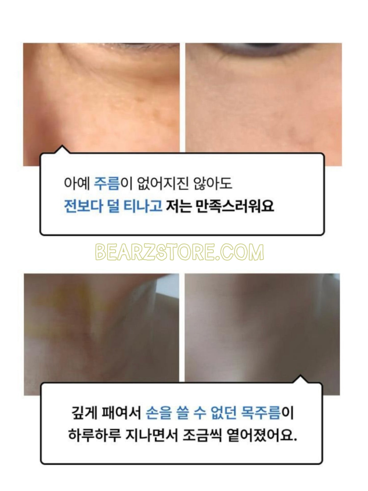 Celimax 視黃醇毛孔緊緻亮白精華 Retinal Shot Tightening Booster| 深入肌底 重塑緊緻彈力💫