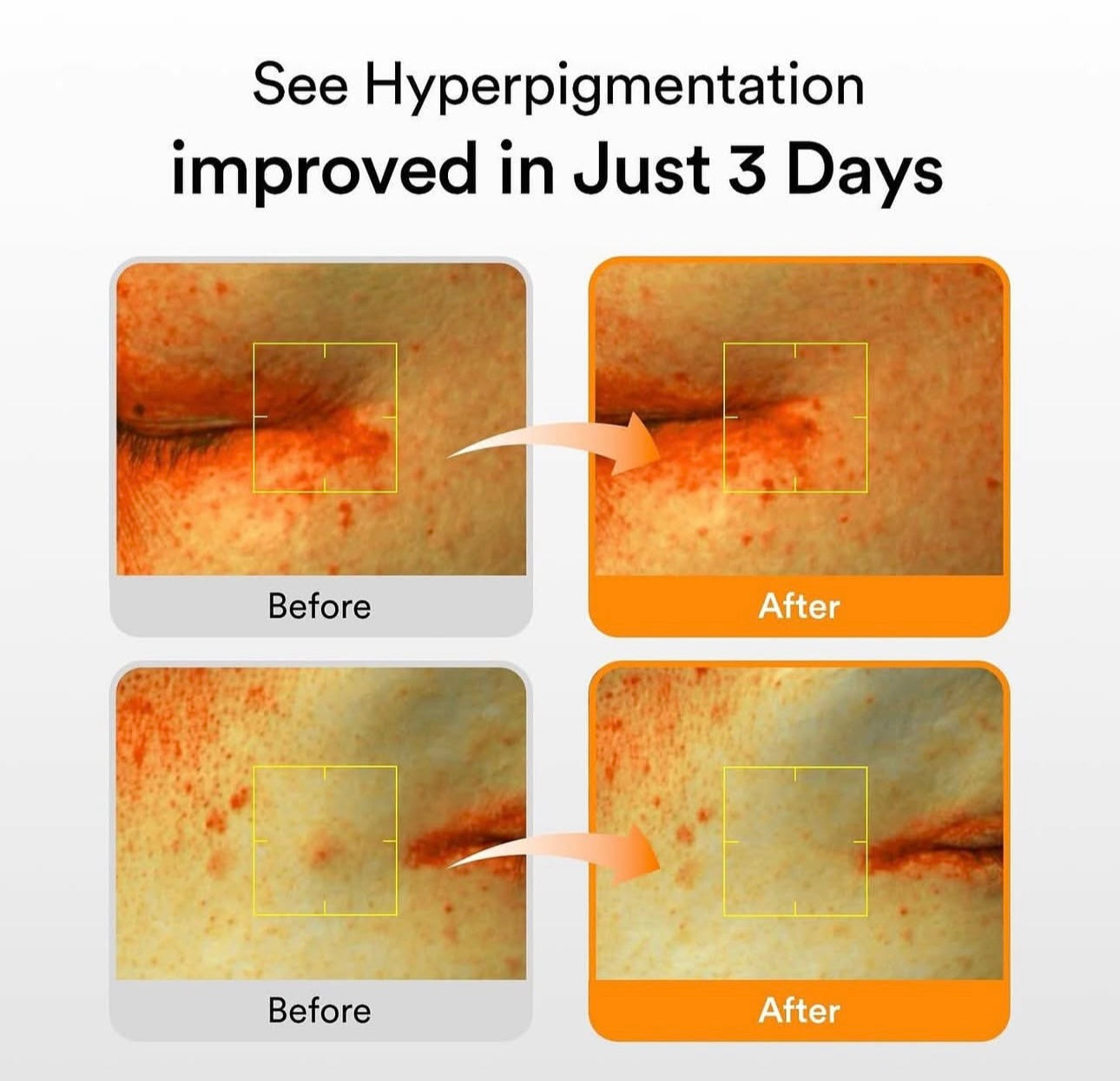 專業淡斑黑科技✨Abib 穀胱甘肽淡斑精華🧡| Abib Glutathiosome dark spot serum