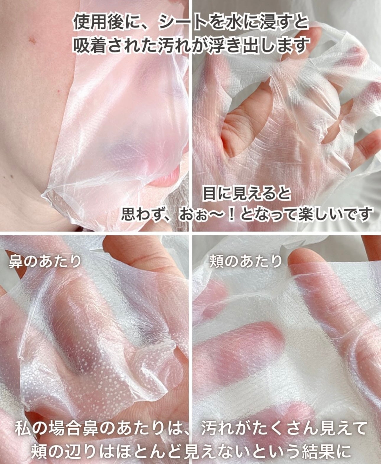 全面瑕疵的大型救星✨ EIoM 縮時淨痘粉刺調理修護面膜EIoM Trouble Patch Mask