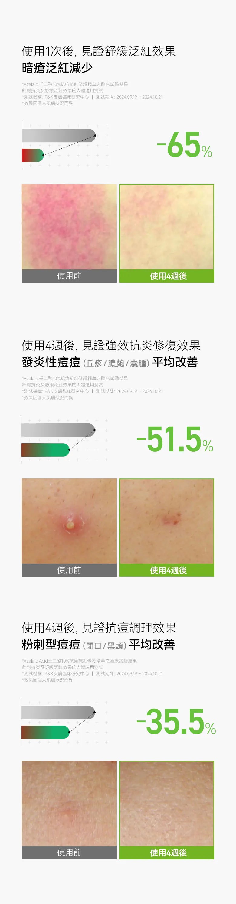 Anua Azelaic壬二酸10%抗痘抗紅修護精華💚