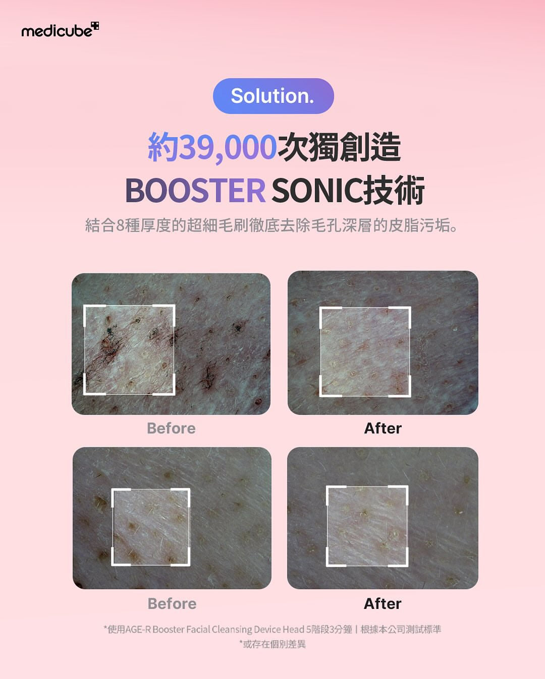 張員瑛代言🔥Medicube AGE-R Booster Cleanser 淨透光澤震動潔面儀