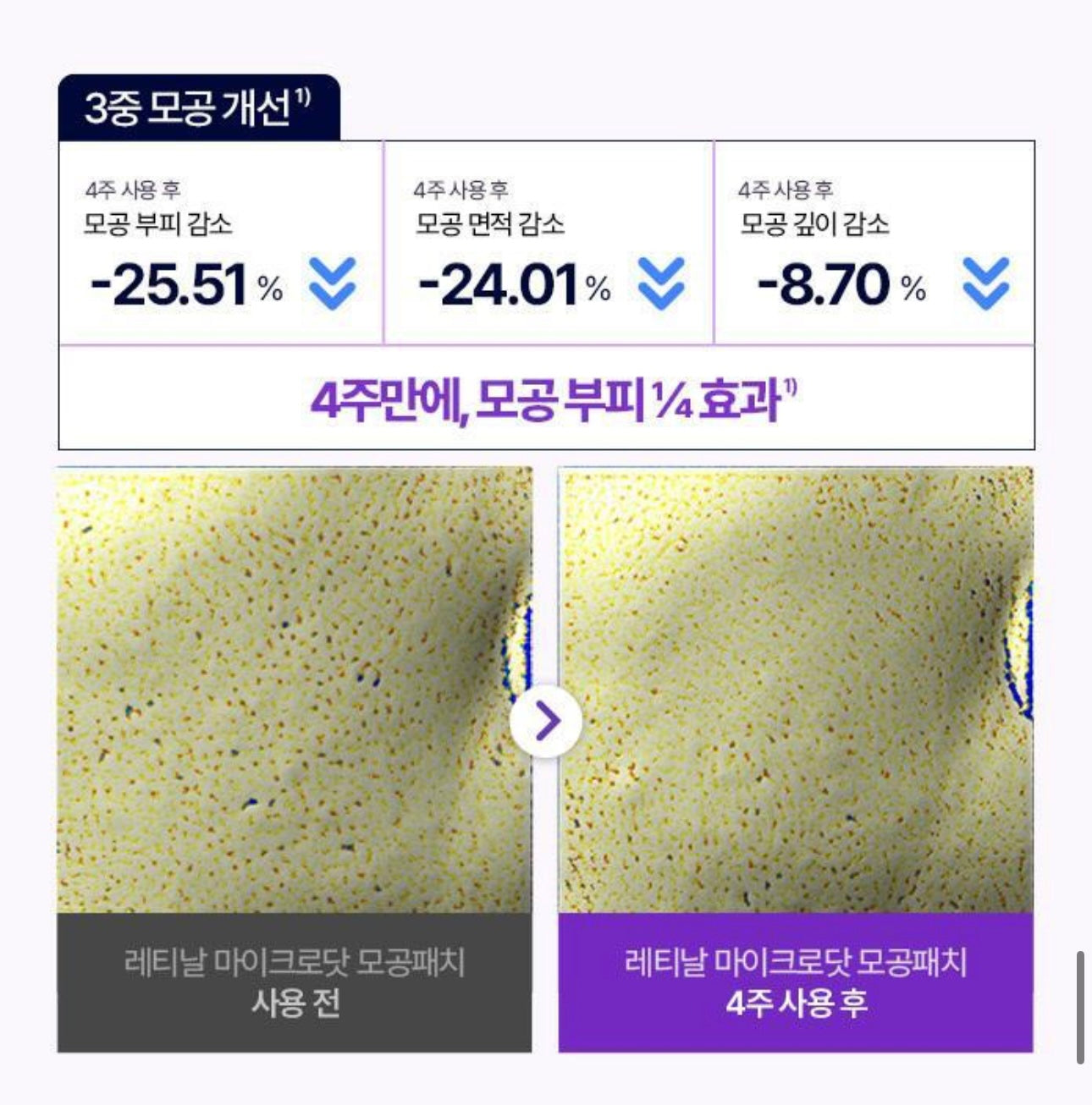針對毛孔粗大✨CAREPLUS 視黃醇毛孔縮小微針貼片💜| CAREPLUS Retinal Pore Micro Dot Patch