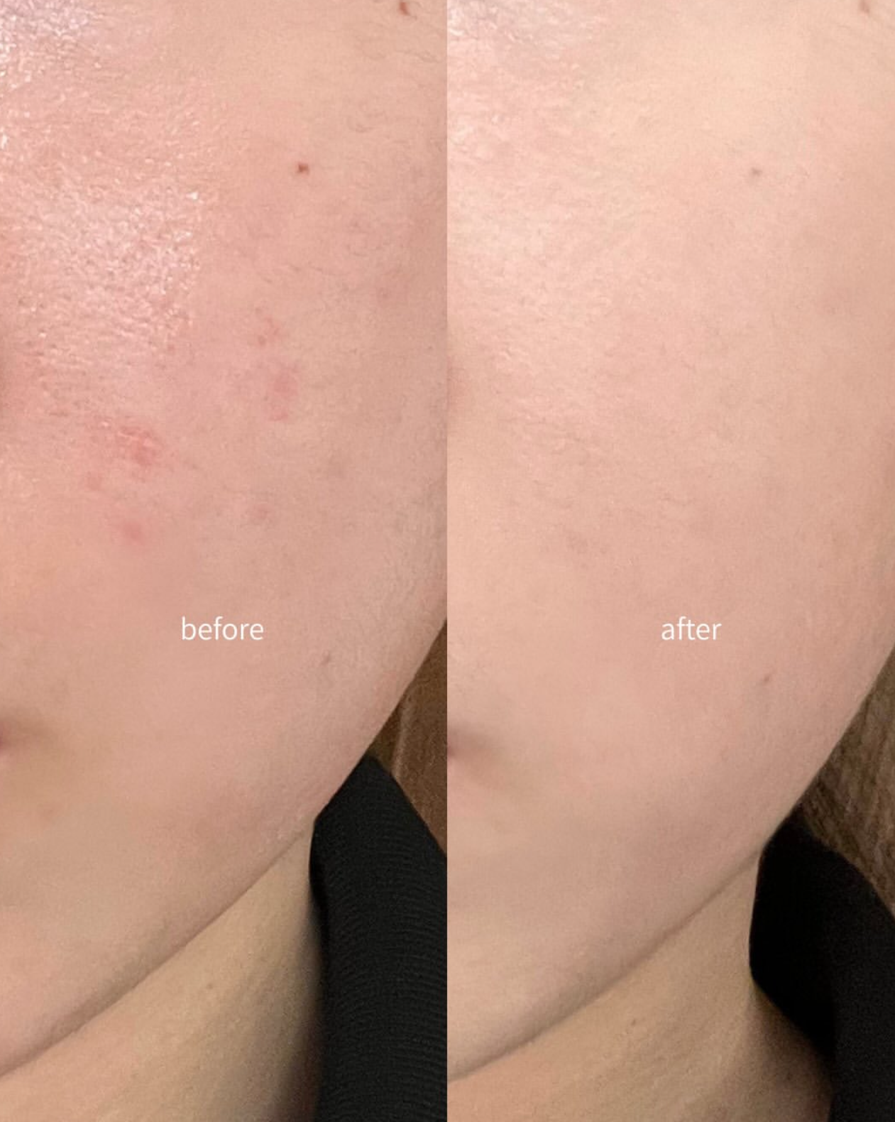 韓國熱賣🔥高遮瑕度🪄TFIT 完美無瑕持久水潤三色遮瑕膏