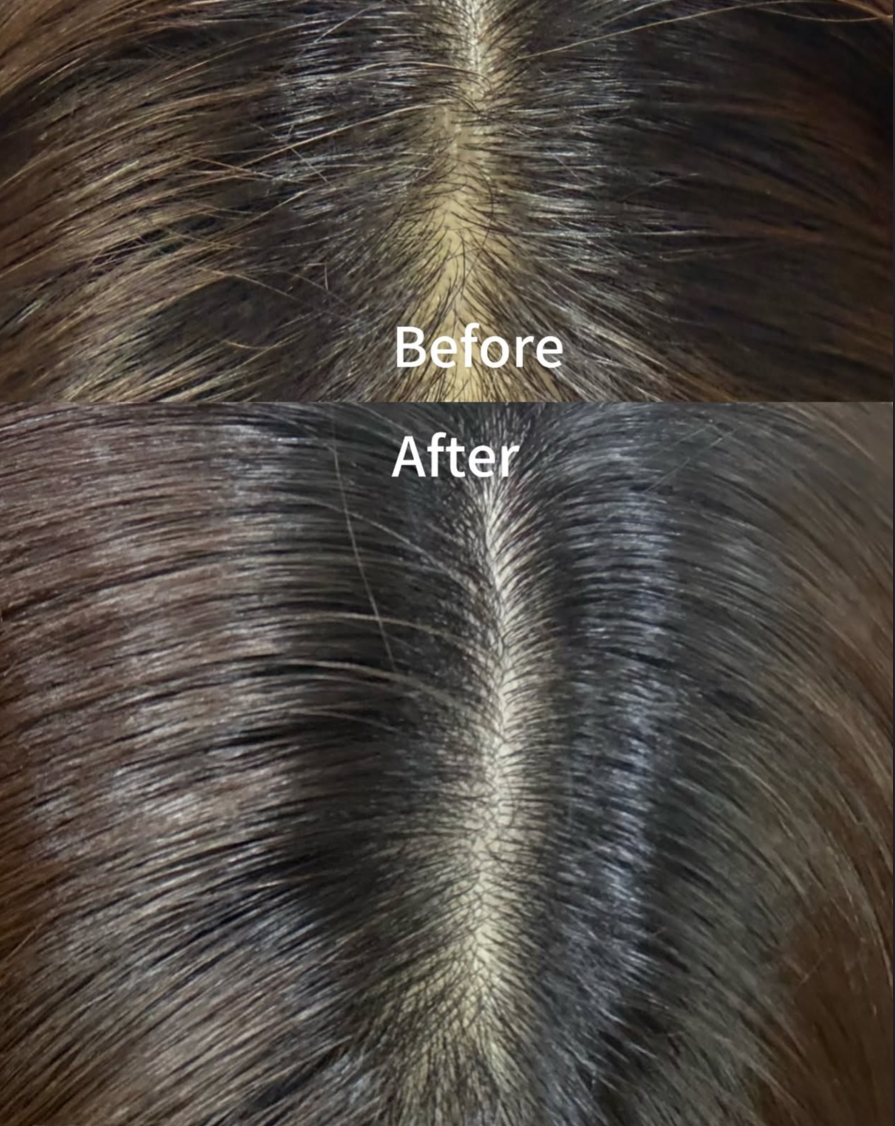 頭皮既微針精華✨Bananal 高濃度微針頭皮修護滾珠精華💫| Bananal Intensive Scalp Ampoule👱🏻‍♀️