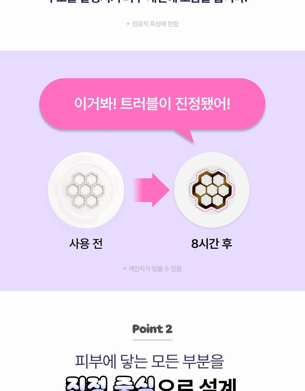 送鎖匙扣袋仔✨Easyderm微針修復隱形暗瘡貼💜