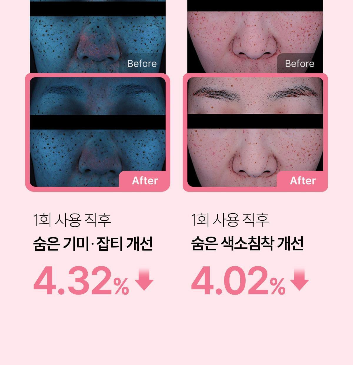 MediCube PDRN粉色肽安瓶面膜💖