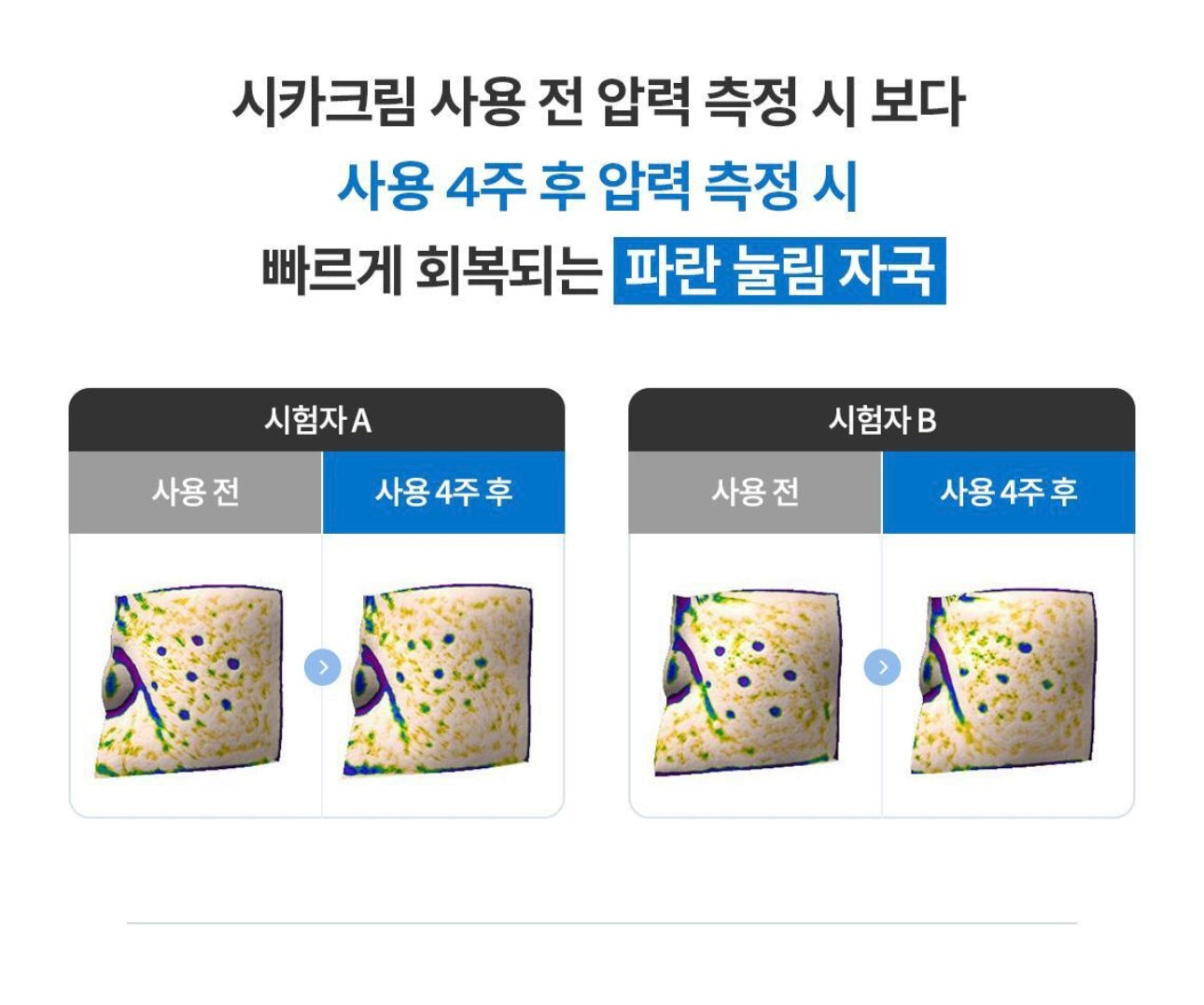 修復霜+精華✨全球皮膚科醫師推薦👩🏼‍⚕️La Roche-Posay Cicaplast B5+全面修復萬用霜🩵