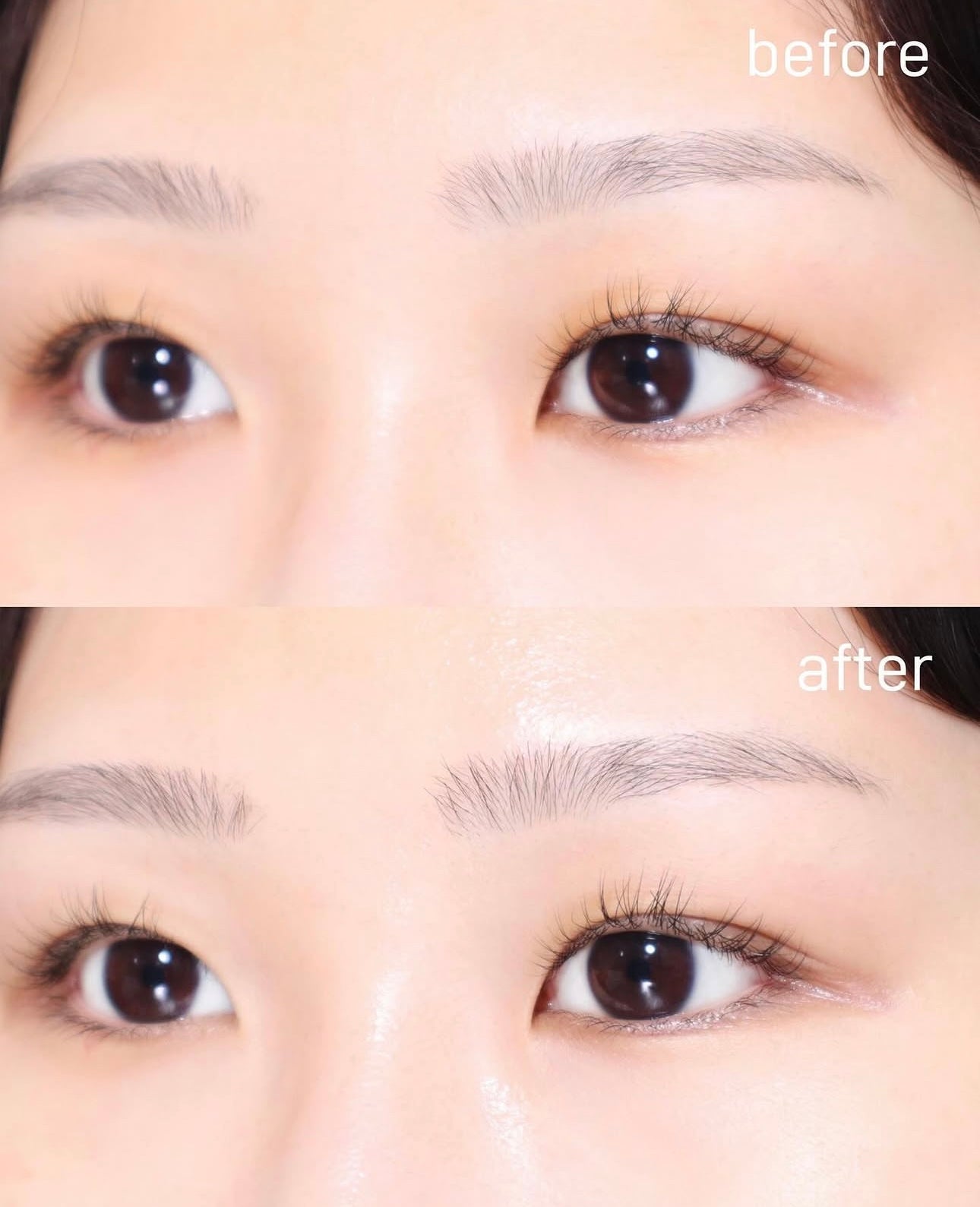 ISOI保加利亞玫瑰精華緊緻亮白修護眼膜🌹| ISOI BLEMISH CARE EYE & WRINKLE PATCH