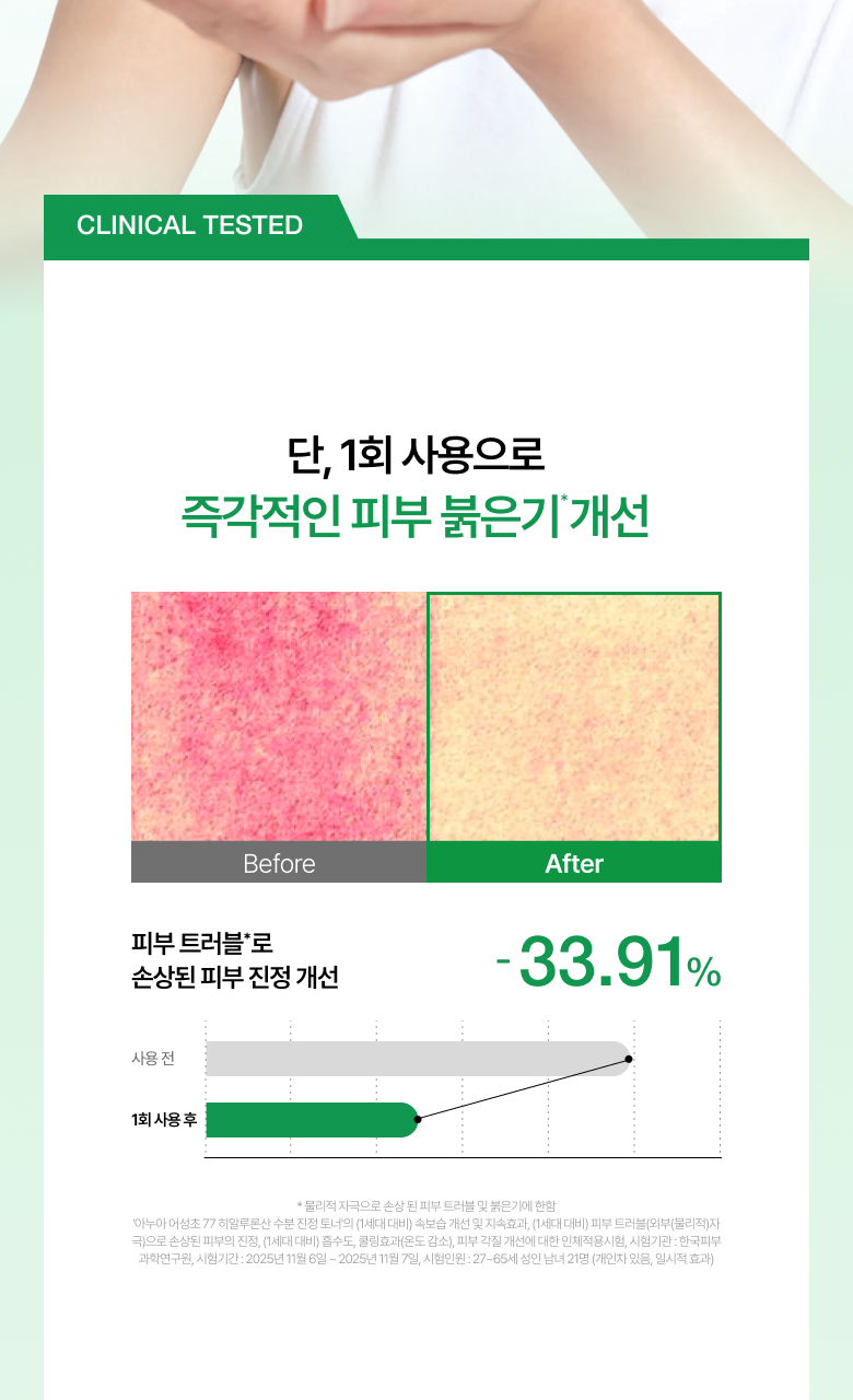 共700ml+送面霜20ml🔥升級版✨回購率高達95%！韓國小眾護膚品牌🇰🇷| Anua 77% 魚腥草去暗粒爽膚水💚| Heartleaf 77% Soothing Toner