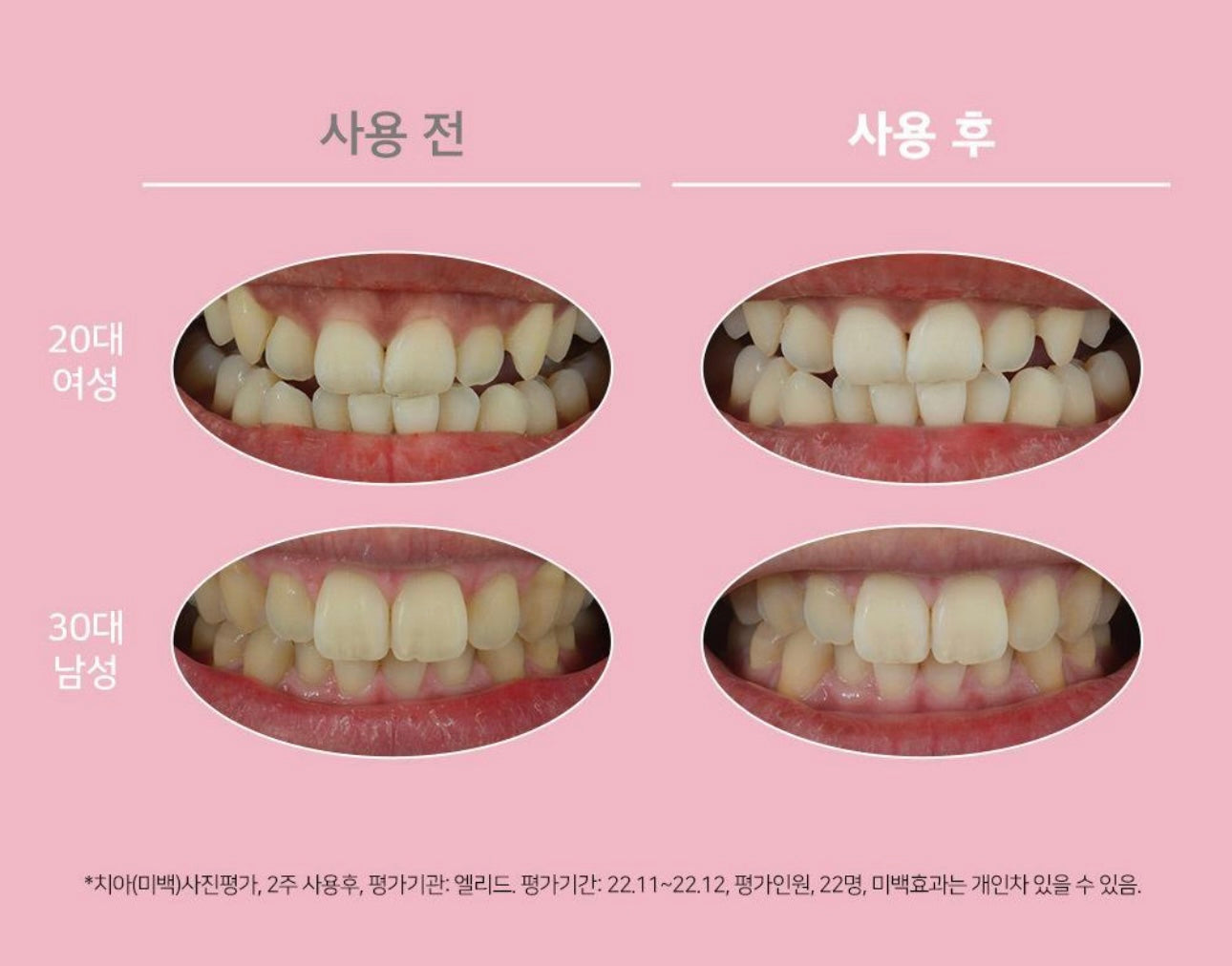 Euthymol 美白提亮牙膏 Whitening Purple Corrector Toothpaste💜