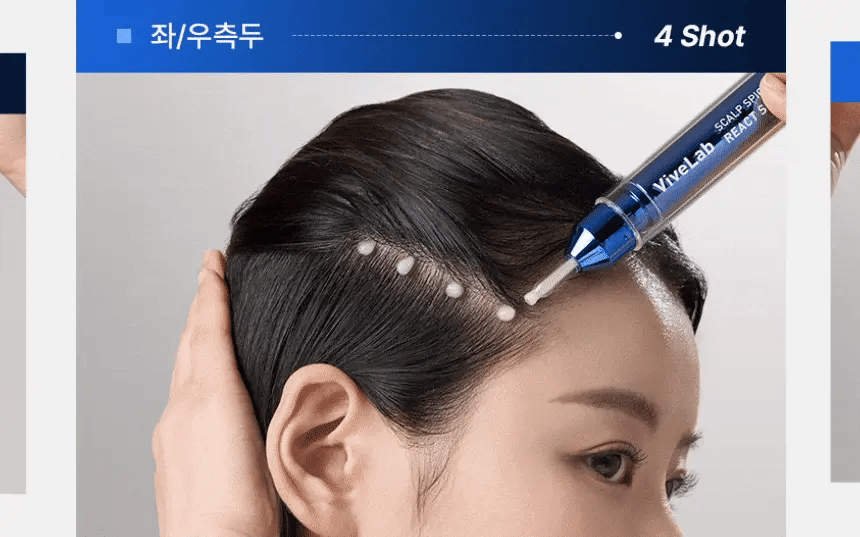 頭皮微針入門首選｜ViveLab 育髮防脫髮安瓶 Spioxyl ReactShot 400👩🏼‍⚕️