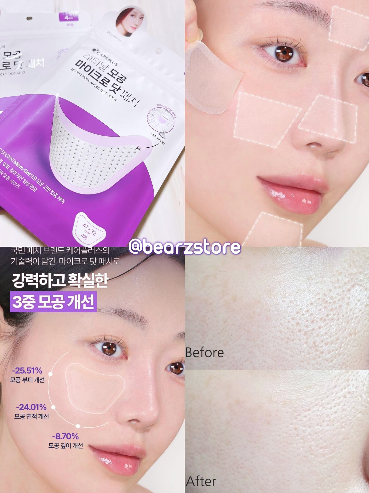 針對毛孔粗大✨CAREPLUS 視黃醇毛孔縮小微針貼片💜| CAREPLUS Retinal Pore Micro Dot Patch