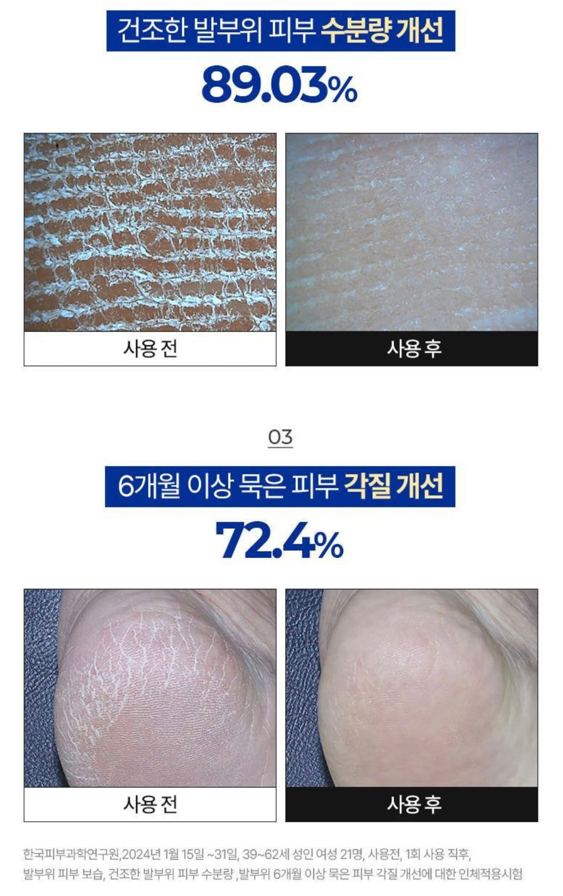 腳跟經常龜裂的必須入手🔥 MEDIPEEL EGF去角質深層滋潤修護足霜💖