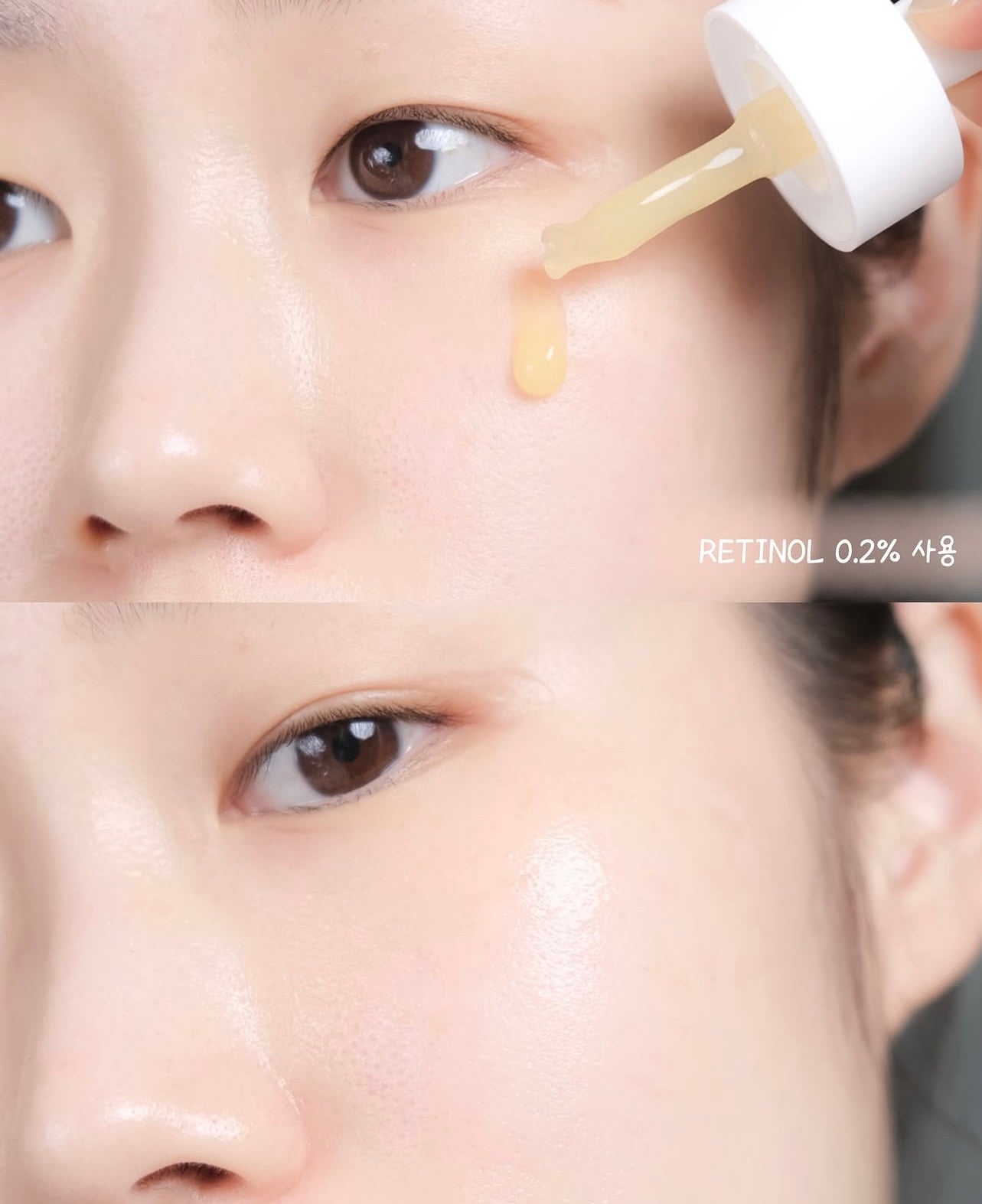 Skin1004馬達加斯加積雪草溫和 A醇微針微導精華0.2%濃度⭐️Skin1004 Retinol 0.2 Boosting Shot Ampoule | 無痛煥膚的秘密在這 ✨