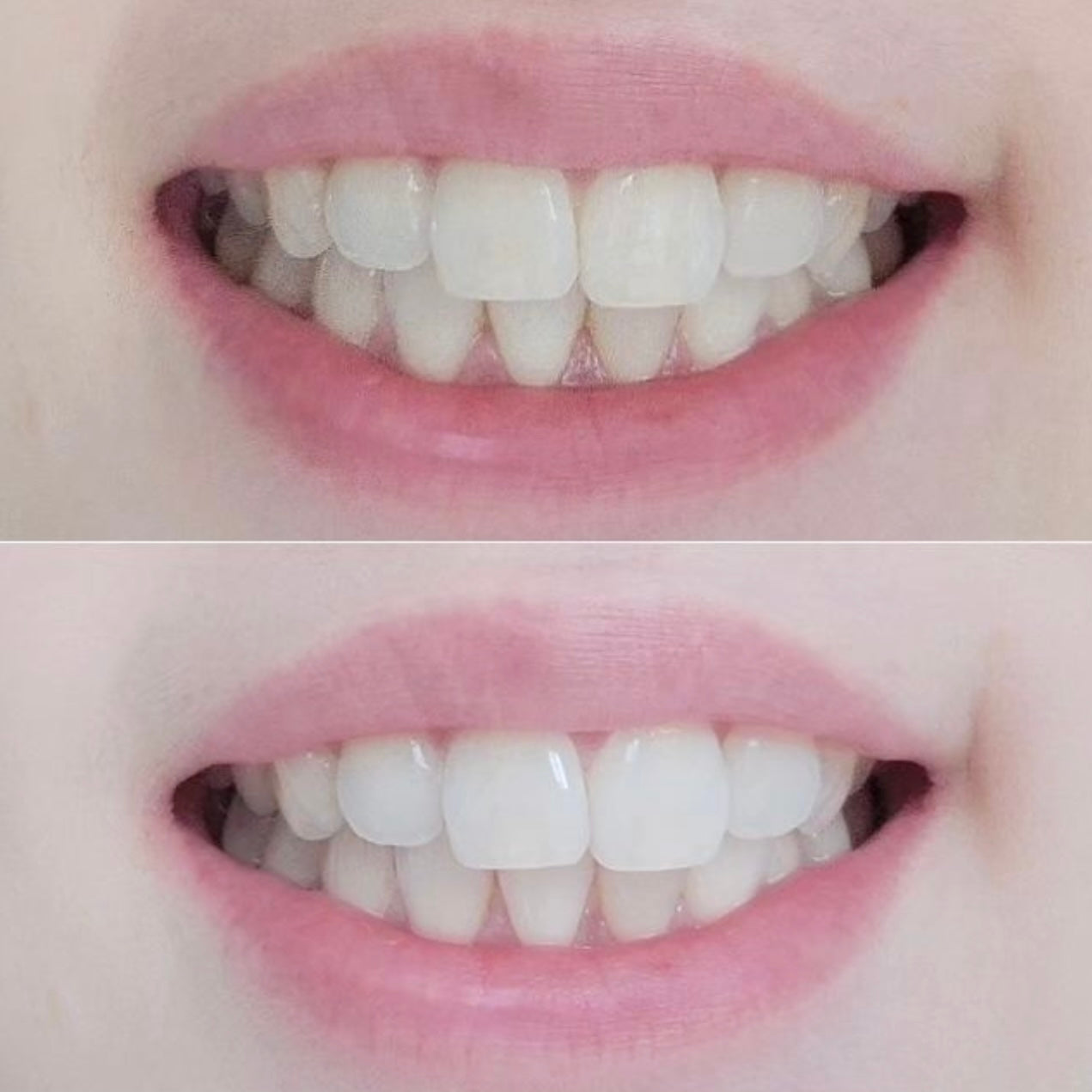 牙齒美白劑 ✨| Vussen 28 專業牙科強效美白牙膏 🦷| Vussen HP28 Extra Whitening Toothpaste🔥