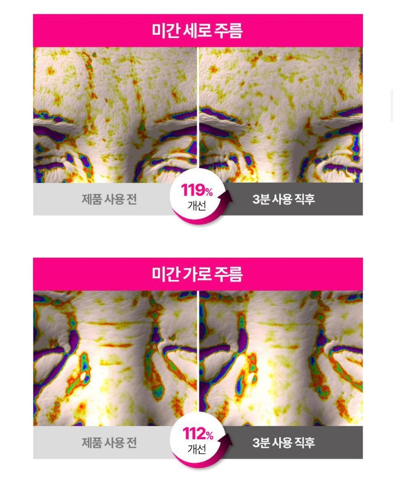 ISOI保加利亞玫瑰精華緊緻亮白修護眼膜🌹| ISOI BLEMISH CARE EYE & WRINKLE PATCH