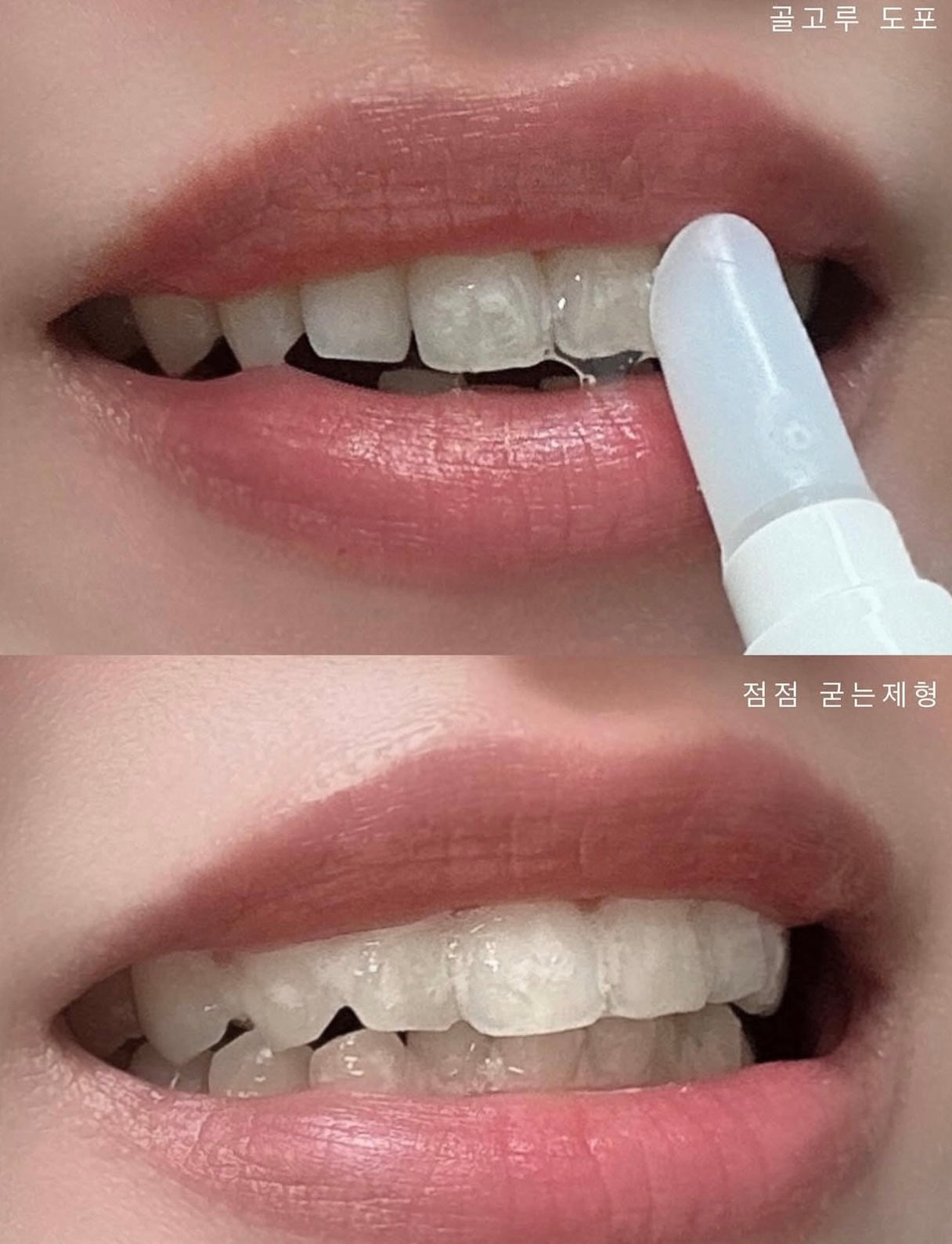 4周見效！Proval Smile Balm 牙齒美白拋光精華🤍🦷