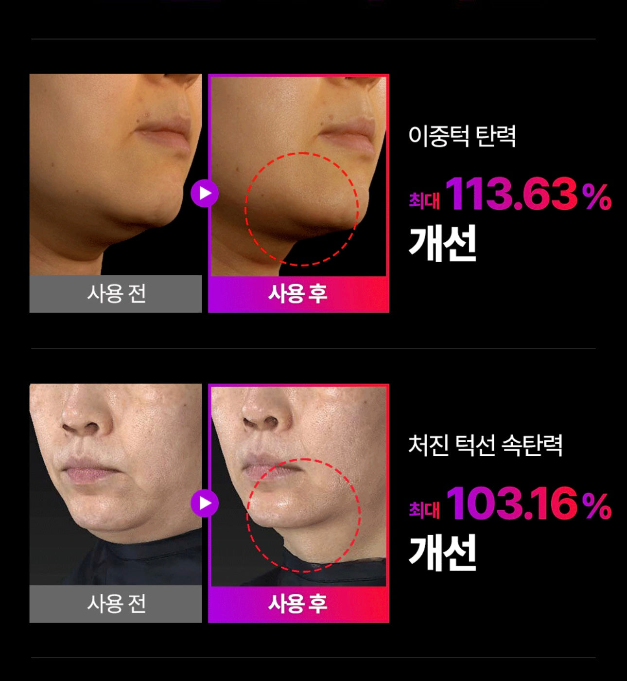 韓國銷量No.1 V面神器🔥Mommy Care EMS V-Thera 面部及全身塑形儀| 韓國愛豆Juhoon同款🙌🏻