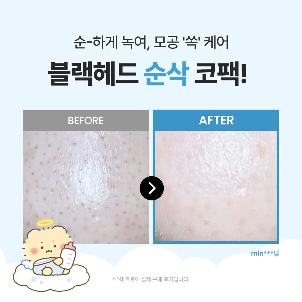 Ilso x 土豆熊限量特別版💖黑頭粉刺必試款🧹| Ilso溶解皮脂收毛孔導出液套裝 Ilso Super Melting Sebum Softener🦋