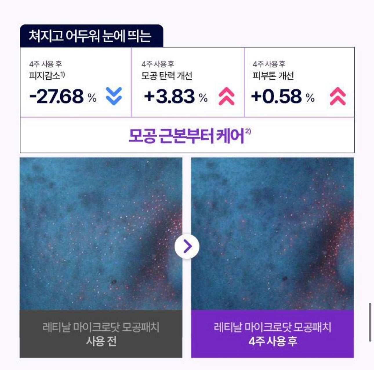 針對毛孔粗大✨CAREPLUS 視黃醇毛孔縮小微針貼片💜| CAREPLUS Retinal Pore Micro Dot Patch