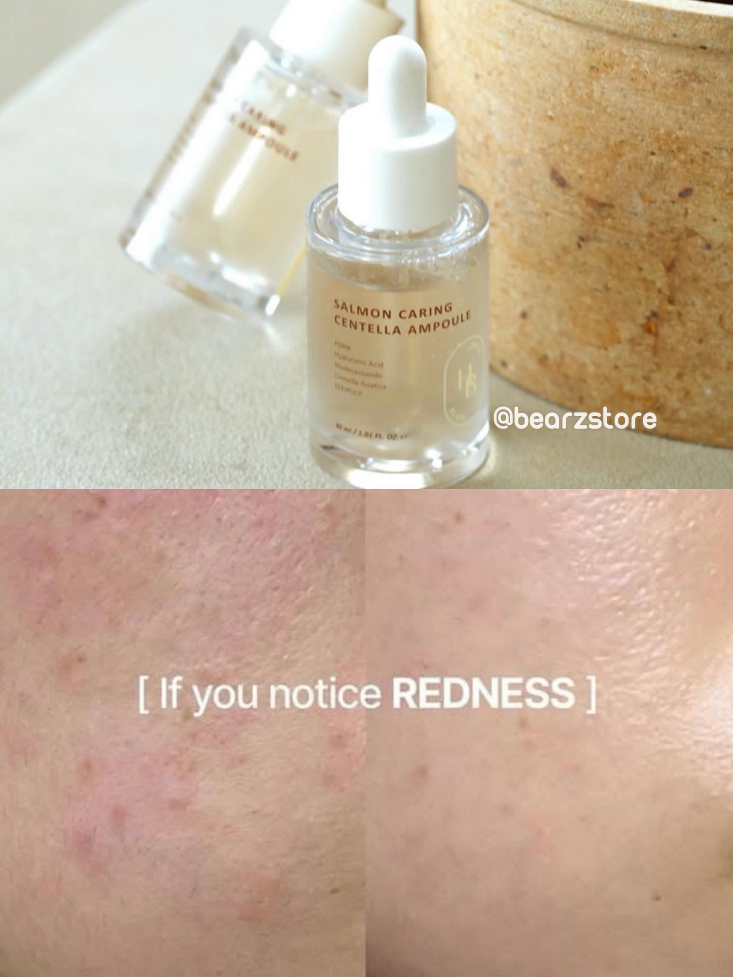 Aespa x IVE 御用化妝師強✨Heveblue 高濃度奢華三文魚PDRN再生修護精華🍣 | Heveblue Salmon PDRN Caring Centella Ampoule | 敏感肌膚純素護膚🤍