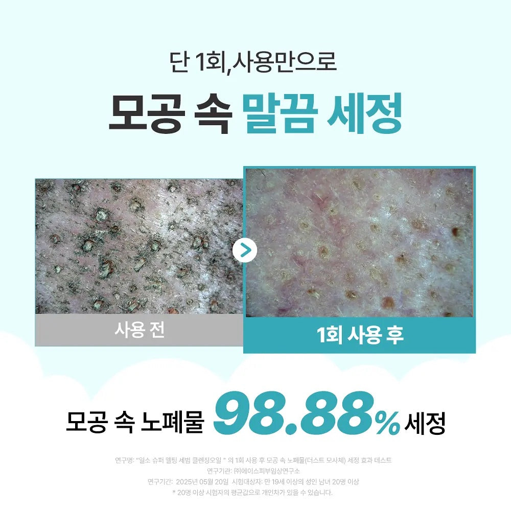 送土豆熊髮圈✨ ilso x 土豆熊限量版天然溫和溶黑頭清毛孔卸妝油套裝Ilso natural mild cleansing oil set🪄