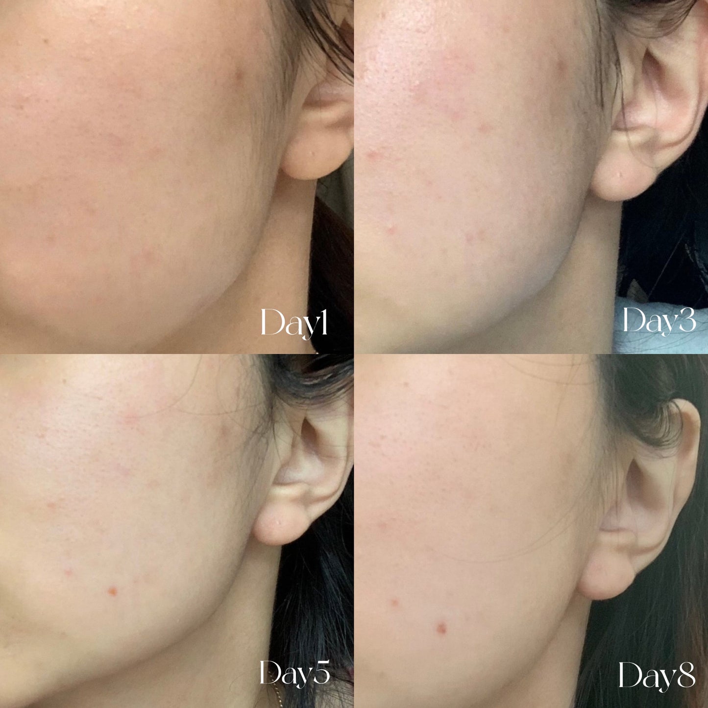 全新升級版💫✨新版本2倍濃度🍊 Goodal皇牌升級版青橘子維他命C淡斑精華ALPHA 💛 | 2週告別瑕疵💡