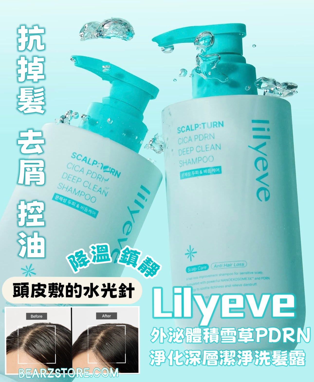 🌊【油頭救星、頭皮敷的水光針】Lilyeve 外泌體 積雪草PDRN 淨化深層潔淨洗髮露🧊Lilyeve Scalp Turn Cica PDRN Deep Clean Shampoo🩵