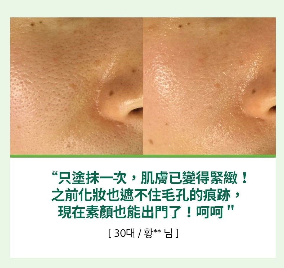 韓國大熱收毛孔精華🔥| Sungboon Editor 綠蕃茄緊緻毛孔精華 green tomato pore lifting ampoule💚| 針對不同類型毛孔問題🪄