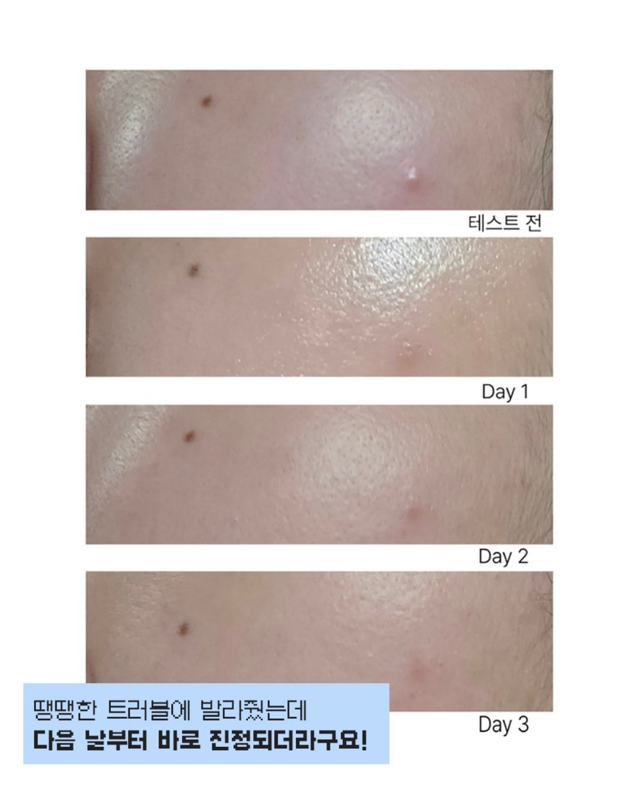 「斷貨預警」🚨 Isoi亮白舒緩淡斑精華💫去黃淡斑淡印最有感 💡 Brightening Calming Spot Serum