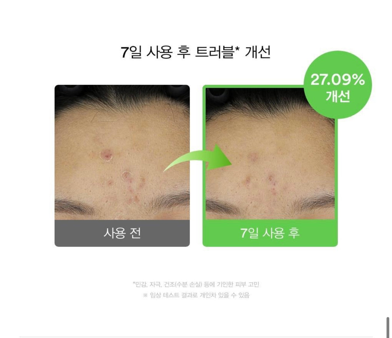 Abib 魚腥草積雪草舒緩膠囊精華液 🌿 Abib Heartleaf TECA Capsule Serum 敏感肌的安心選擇🧏🏻‍♀️