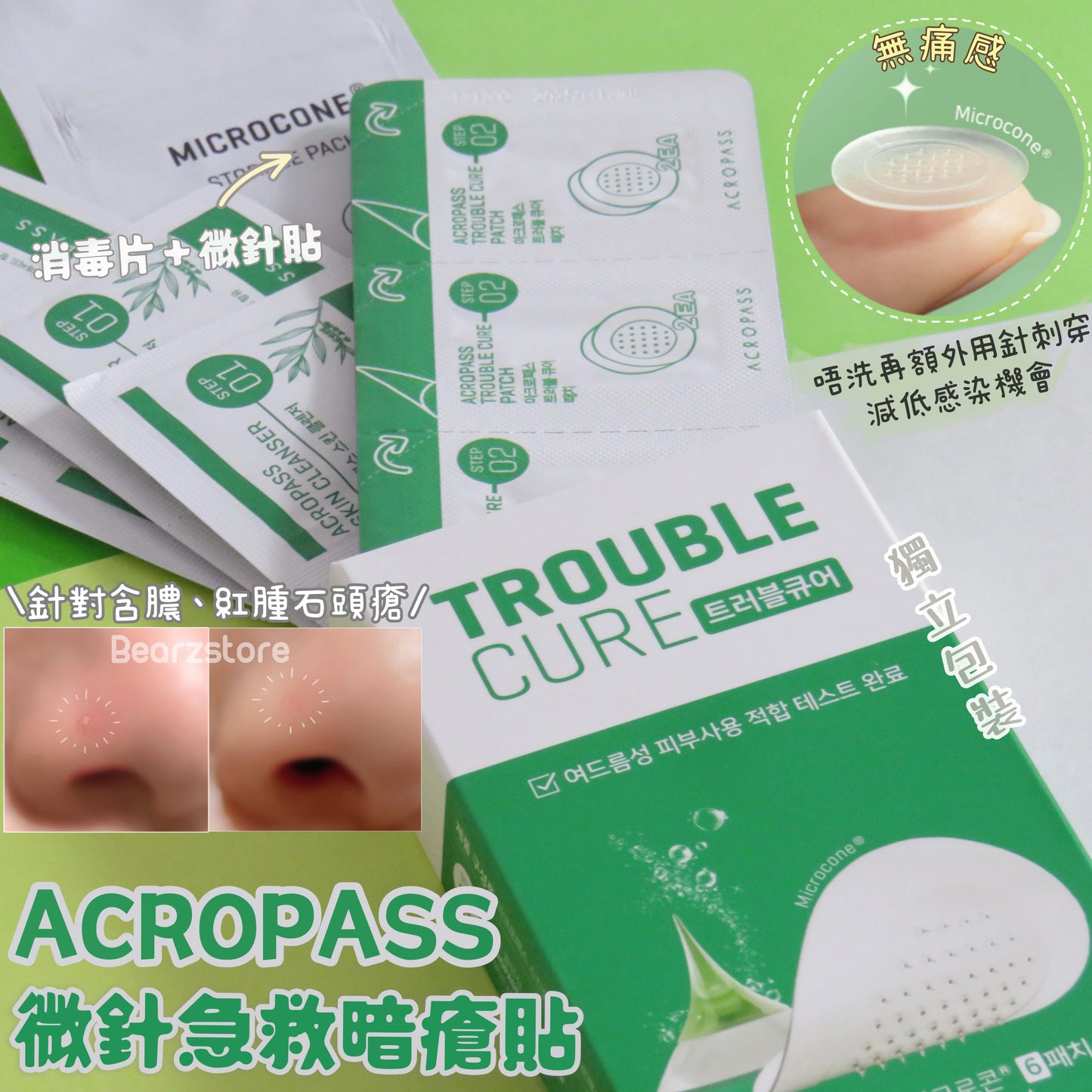 ACROPASS微針肌膚急救暗瘡貼 AC Care Essence Patch | 針對含膿或紅腫石頭瘡✨