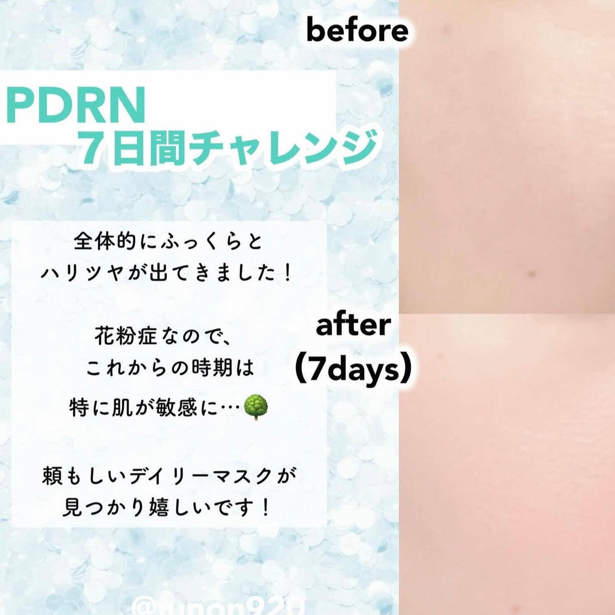 快速便捷亮膚護理 ⭐️|VT Cosmetic PDRN日常護理急救保濕煥亮膚面膜💧VT Cosmetics PDRN Daily Mask 30 sheets