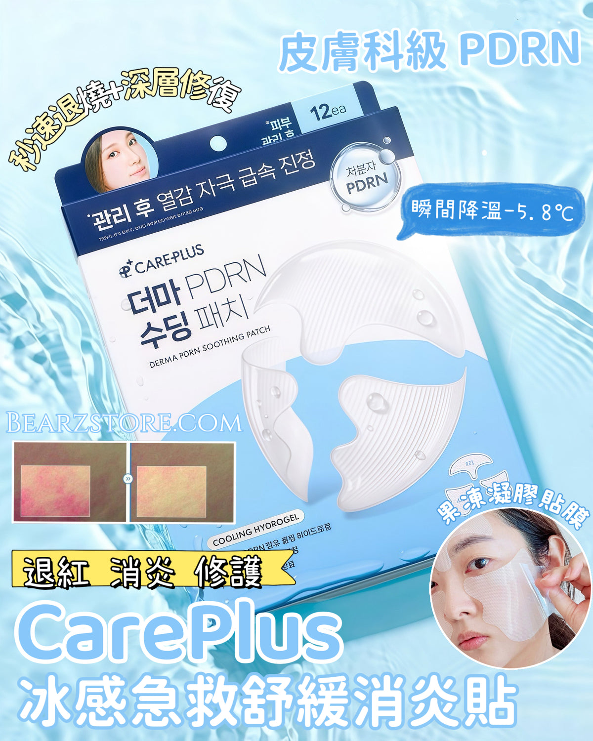 🔥 【退燒級降溫】拯救大紅臉！CarePlus 皮膚科級 PDRN 冰感急救舒緩消炎貼 ❄️ 專為敏弱高溫肌研發💡 CarePlus DERMA PDRN SOOTHING PATCH