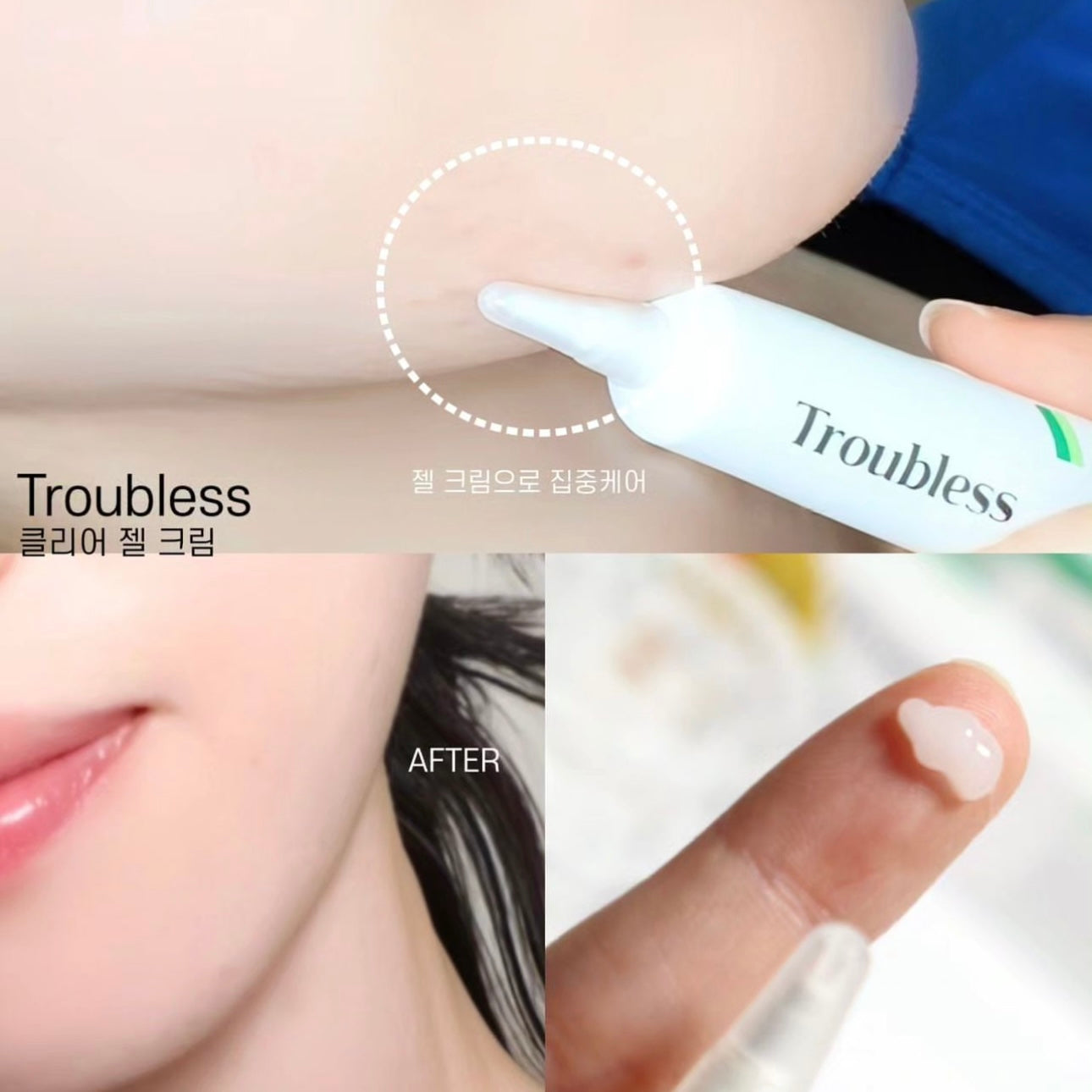 韓國暗瘡專家品牌🌟 |Troubless 多重茶樹抗痘去印霜Troubless Clear Gel Cream 🌿