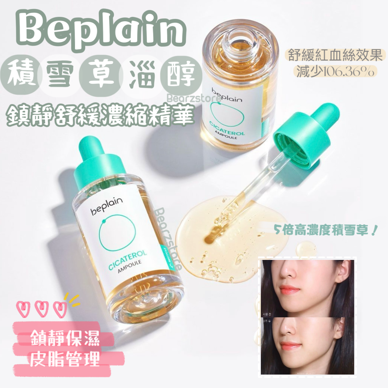 快速去敏🚨| Beplain積雪草淄醇鎮靜舒緩濃縮精華|Beplain Cicaterol Ampoule🌿