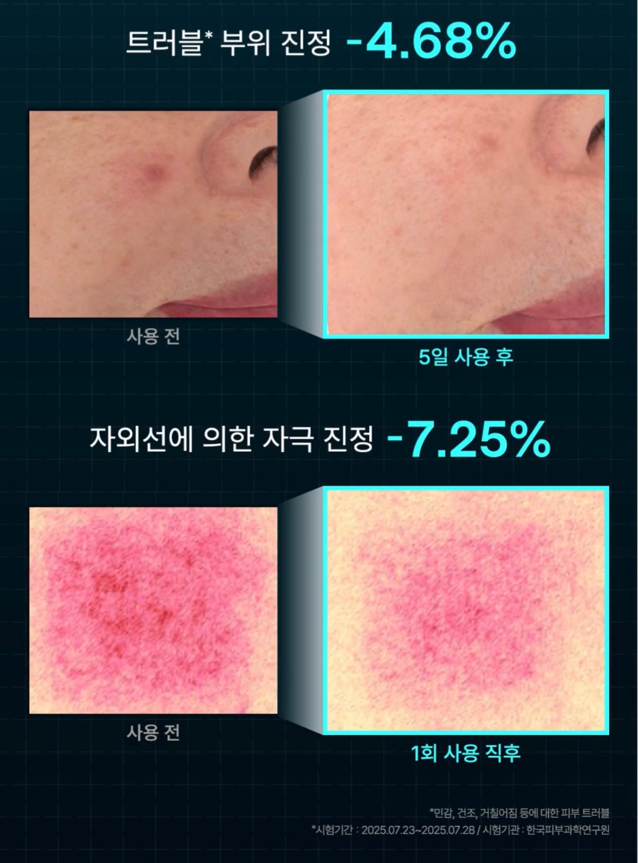 MEDIHEAL 98%積雪草抗炎去印去痕跡修護霜🩵| MEDIHEAL MADECASSOSIDE DERMA ACTIVE CAPSULE CREAM