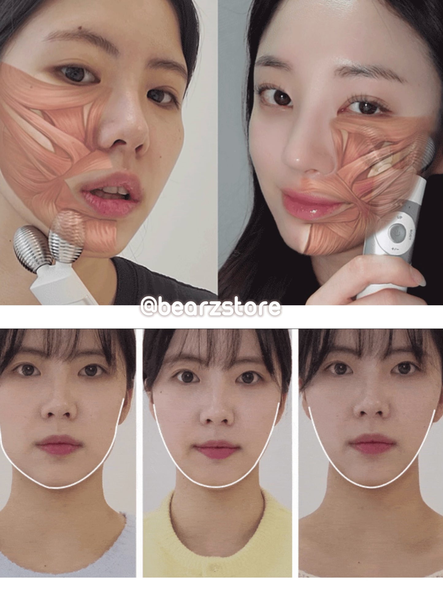 韓國銷量No.1 V面神器🔥Mommy Care EMS V-Thera 面部及全身塑形儀| 韓國愛豆Juhoon同款🙌🏻