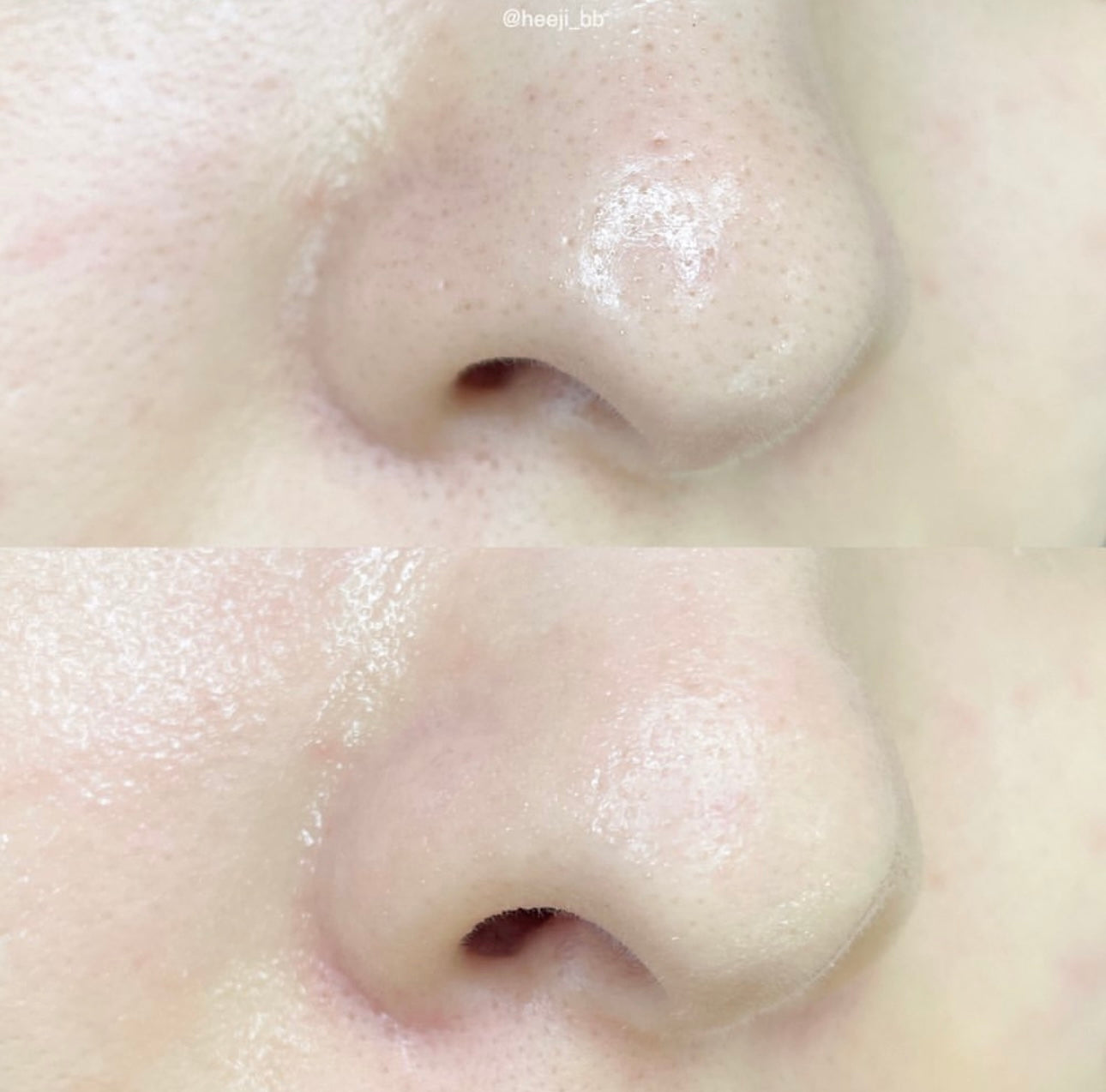 IU同款全韓國第一鼻貼 CNP Laboratory溫和去黑頭收毛孔鼻貼無刺激💚